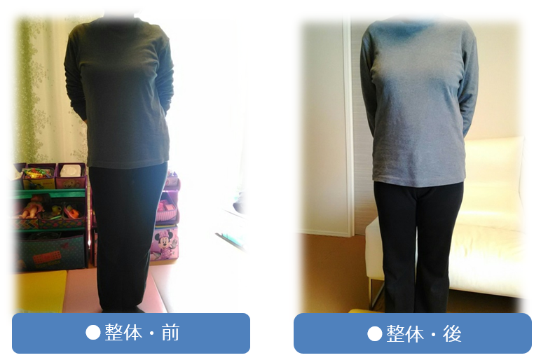ぎっくり腰でお困りなら出張整体