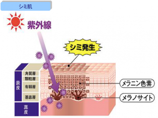 シミ肌 - コピー